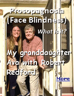 Prosopagnosia is a condition where you struggle to recognize faces or can't interpret facial expressions and cues. It usually happens because of brain damage, but some people have it at birth. Treatment focuses on underlying causes or helping you adapt so you can recognize people in other ways. I've been told for years that I have ''Robert Redford's hair'', but only once did I run into a woman who, while not positive, thought I was the guy.